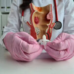 Hemorrhoid Treatment 