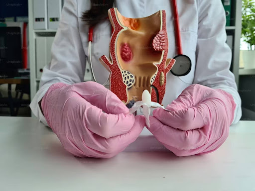 Hemorrhoid Treatment 